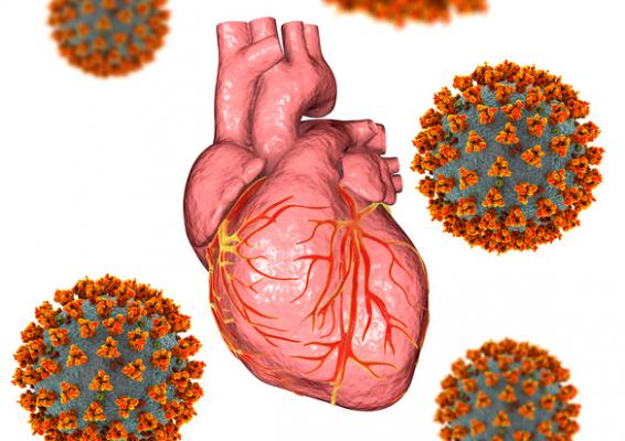 Cardiovascular Disease Deaths